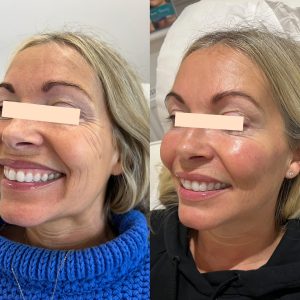 469326502_18315005899162289_5995379963816627267_n