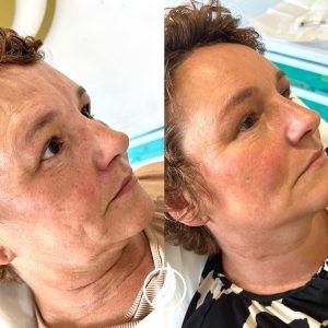 469555292_18315102001162289_5446995322081944806_n