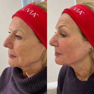 474464314_18321477517162289_2746682514650746919_n