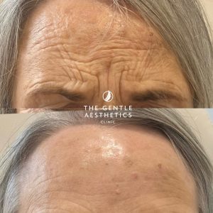 483889681_18325685101162289_7525856757194480217_n