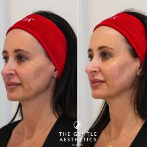 488780645_18328379830162289_6187351111742997419_n