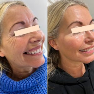 7CC64D9D-57A6-435F-BEB5-5C9A957A0440